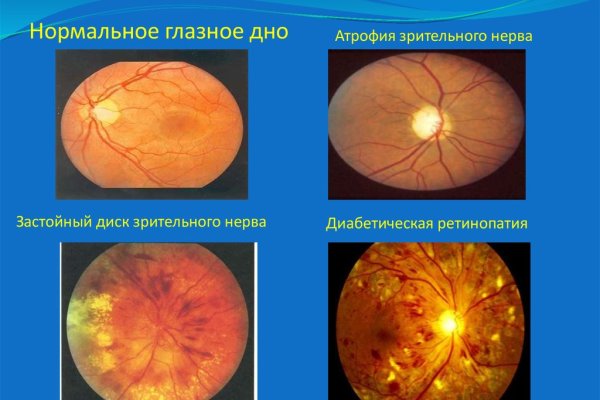Ссылки на сайты даркнета